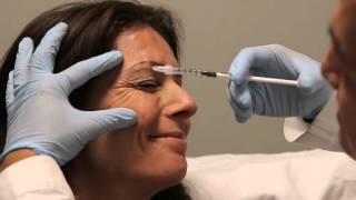 Crows Feet botulinum toxin injection training [upl. by Ailyn]