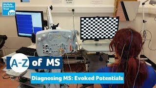 Diagnosing MS  Evoked potentials tests [upl. by Carol-Jean]