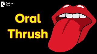 Oral thrush Causes Symptoms Treatment  Oral thrush contagious [upl. by Atterehs]