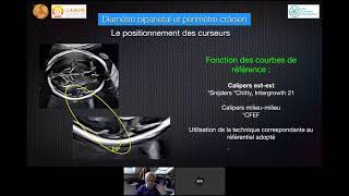 BIOMÉTRIE FOETALE BIEN MESURER  ÉCHOGRAPHIE OBSTÉTRICALE [upl. by Mariejeanne662]