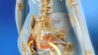 Sacral Neuromodulation  MOA Animation [upl. by Tonina]