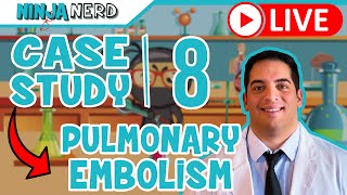 Case Study 8 Pulmonary Embolism [upl. by Pass]