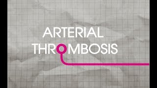 Arterial Thrombosis Explained [upl. by Jodoin]