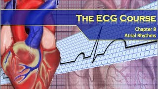 The ECG Course  Atrial Rhythms [upl. by Ruy225]