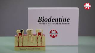 Biodentine mixing instructions [upl. by Schindler]