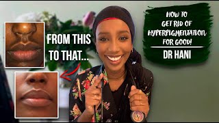 How To Get Rid Of Hyperpigmentation  Dr Hani [upl. by Hendrik239]