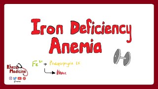 IRON DEFICIENCY ANEMIA Causes Clinical Features Pathophysiology Diagnosis Treatment  Rhesus [upl. by Cappello741]