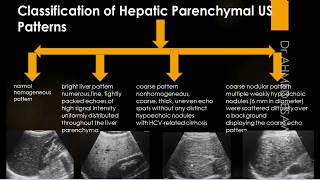 Liver Ultrasound Diffuse Disease Cirrhosis  fibrosis  Scoring  Hepatitis  Autoimmune  Contra [upl. by Dorrej]