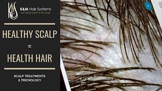 HEALTHY SCALP  HEALTHY HAIR  TRICHOLOGY [upl. by Cyn]