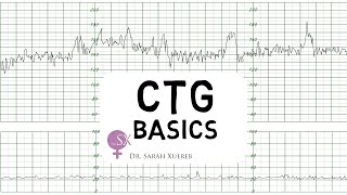 CTG Basics [upl. by Renrew]