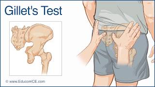 Gillets Test for Sacroiliac dysfunction  Chiropractic Online CE™ [upl. by Knuth666]