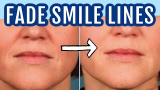 12 ways to fade smile lines nasolabial folds Dr Dray [upl. by Oiramaj750]