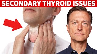 SIGNS THAT YOU HAVE A LOW THYROID LEVEL  Hypothyroidism Symptoms [upl. by Olzsal303]