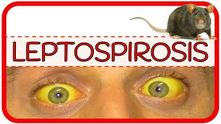 LEPTOSPIROSIS – fisiopatología microbiología signos y síntomas diagnóstico y tratamiento [upl. by Willis]