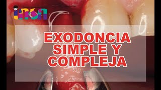 Exodoncia Simple y Compleja  Telecapacitación INSN [upl. by Xonk]