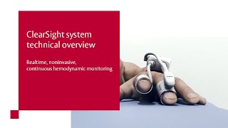 ClearSight system technical overview [upl. by Zerlina]