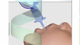 Neonatal Endotracheal Intubation [upl. by Essilevi602]