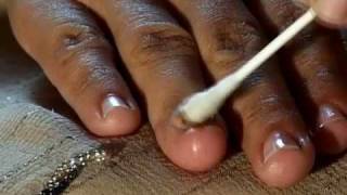 How to Cure Nail Fungus [upl. by Souvaine258]