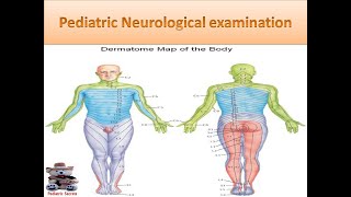 Pediatric Neurological examination [upl. by Aihpledalihp]