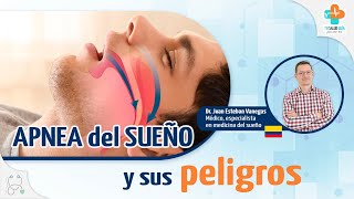 Apnea del sueño Síntomas y señales de alarma [upl. by Sille]