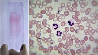 Blood Smear Preparation and Staining Practical Lab [upl. by Cimbura]