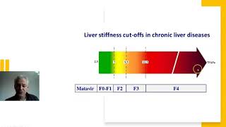 liver fibroscans explained [upl. by Alexei610]