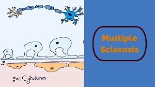 Understanding Systemic Sclerosis [upl. by Gignac67]