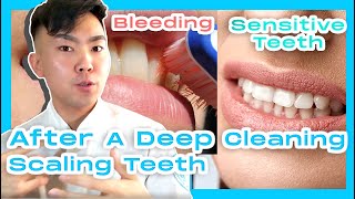 What To Do After A Deep Cleaning Scaling Teeth Root Planing [upl. by Adali712]