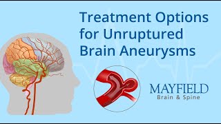 Flow Diverter Treatment of Brain Aneurysm [upl. by Barnard479]