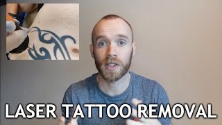 Laser Tattoo Removal  Sessions 13 Update [upl. by Meraree716]