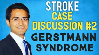 GERSTMANN SYNDROME STROKE CASE PRESENTATION STROKE CASE SCENARIO DISCUSSIONUSMLE [upl. by Yenhpad]