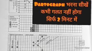 How to fill partograph with example Part3 Practical application of partograph progress of labor [upl. by Gordy]