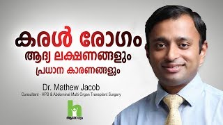 കരൾ രോഗത്തിന്റെ ഈ ലക്ഷണങ്ങൾ സൂക്ഷിക്കുക  Liver Disease Malayalam Health Tips [upl. by Ludewig]