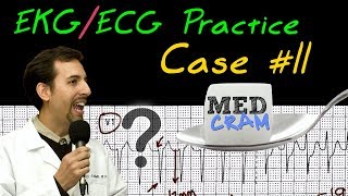 EKG  ECG Interpretation Explained Clearly  Practice Case 11 [upl. by Manaker141]