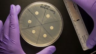 ID Laboratory Videos Antibiotic susceptibility testing [upl. by Akina]