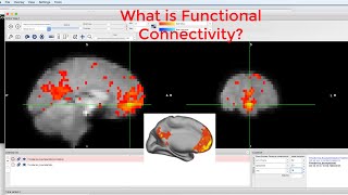 CONN Tutorial 1 What is Functional Connectivity [upl. by Halak]