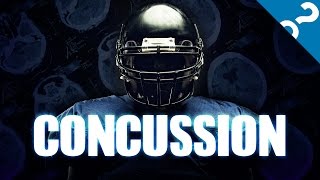 Explain it to me Concussions [upl. by Yelraf]