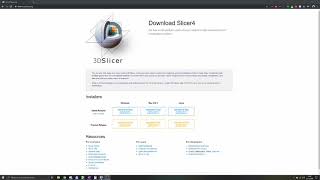 3D Slicer Tutorial 1 Basics [upl. by Williamsen287]