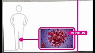 Venous Thrombosis Explained [upl. by Steere806]