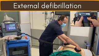 External defibrillation DC Shock [upl. by Ambie]