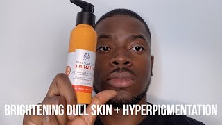 HOW I GOT RID OF DARK SPOTS BRIGHTEN DULL SKIN  HYPERPIGMENTATION [upl. by Winograd]