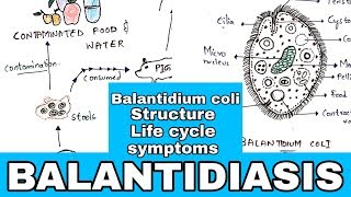 Balantidiasis  Balantidium coli Structure Life cycle Symptoms Medication  Bio science [upl. by Ahsinaw651]