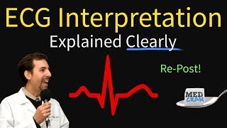 ECG Interpretation Explained Clearly and Succinctly  Arrhythmias Blocks Hypertrophy [upl. by Eelegna]