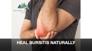 BURSITIS  Patient Education Video [upl. by Eniamrej]