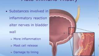 Understanding Interstitial Cystitis IC [upl. by Mount548]