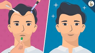 Hair Loss Treatments For Men According To Science [upl. by Anyrak]