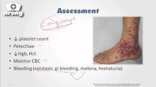 HeparinInduced Thrombocytopenia HIT  A Comprehensive Explanation [upl. by Kcirdek]