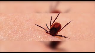 Lyme Disease Treatment  Johns Hopkins 4 of 5 [upl. by Anenahs]