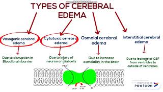 Cerebral edema [upl. by Anahpets]