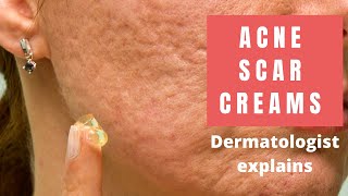 Acne Scar Creams  Dermatologist Reviews [upl. by Notsirhc]